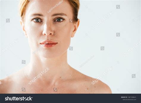 Naked Beautiful Woman Skin Illness Looking Foto Stock