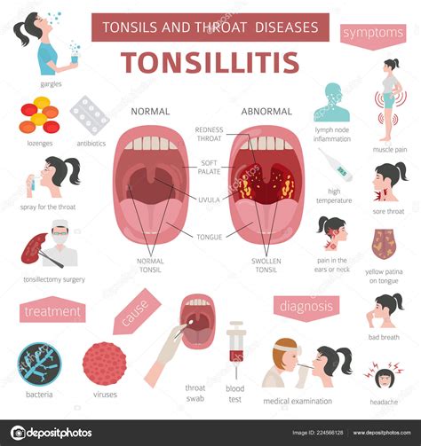 Tonsils Throat Diseases Tonsillitis Symptoms Treatment Icon Set Medical