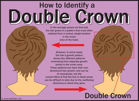 Crown Hair Growth Patterns Usually Are Seen At The Back Of The Head And