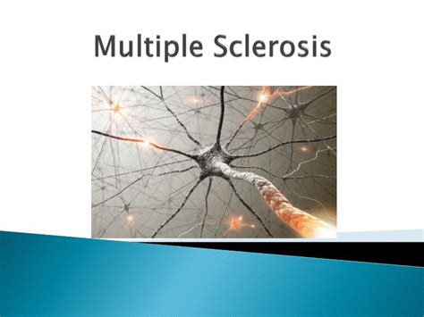 Ppt Multiple Sclerosis Powerpoint Presentation Id 1867144