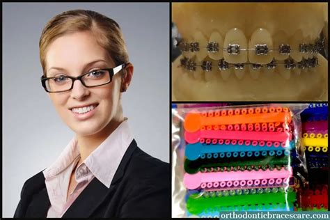 Best Braces Colors For Adults How To Choose Orthodontic Braces Care