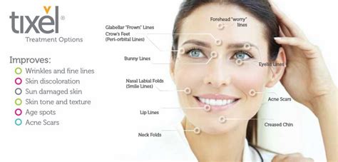 Последние твиты от tixel (@tixelofficial). Tixel Treatment in London & Bucks | The Cosmetic Skin Clinic