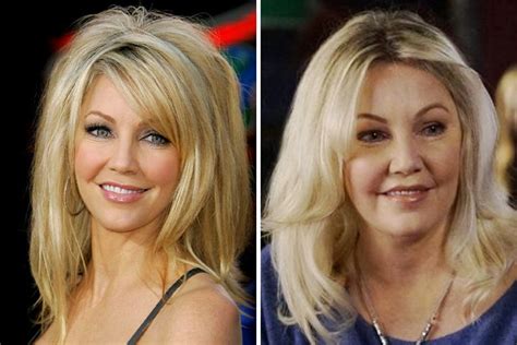 Heather Locklear Before And After Plastic Surgery 8 C