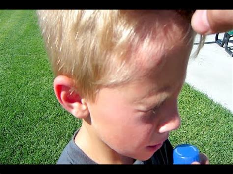 Your baby will probably be able to lift her head when she's about a month old, and hold it up when placed. WHO NEEDS A HELMET - YouTube