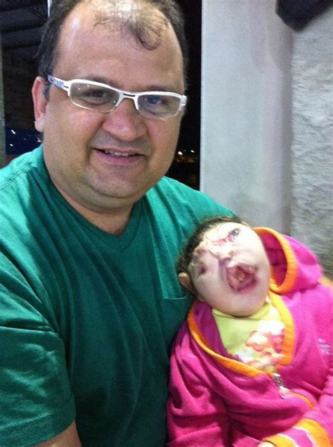Girl Born Without A Face Expected To Die Within Hours