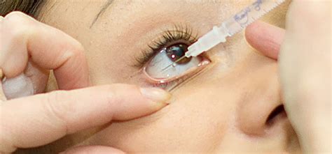 Retinal Injections Navkar Eye And Smile