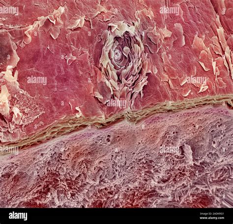 Sweat Pore Coloured Scanning Electron Micrograph Sem Of A Sweat