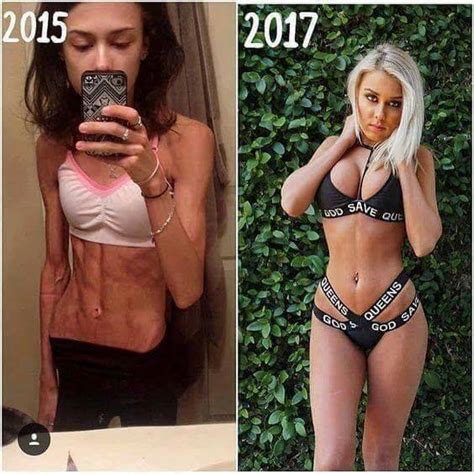 Before And After Sexy Pictures After Anorexia Fitness Lifestyle