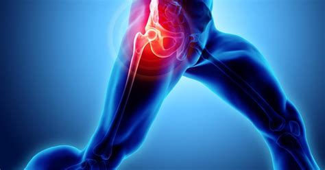 Understanding Anterior Hip Replacement And Its Benefits Over