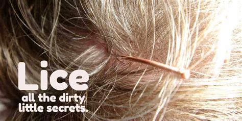 Head Lice Home Remedies