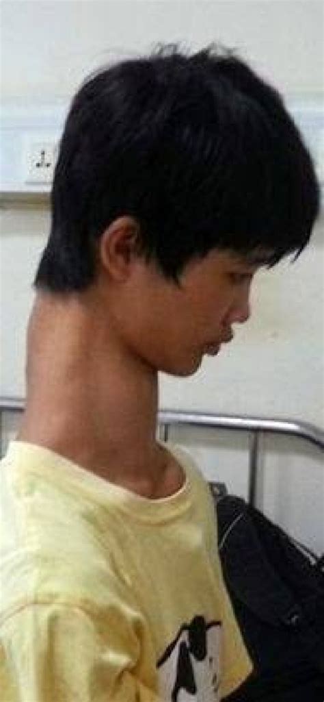 Meet 15 Yr Chinese Boy With Longest Neck In The World The Maravi Post