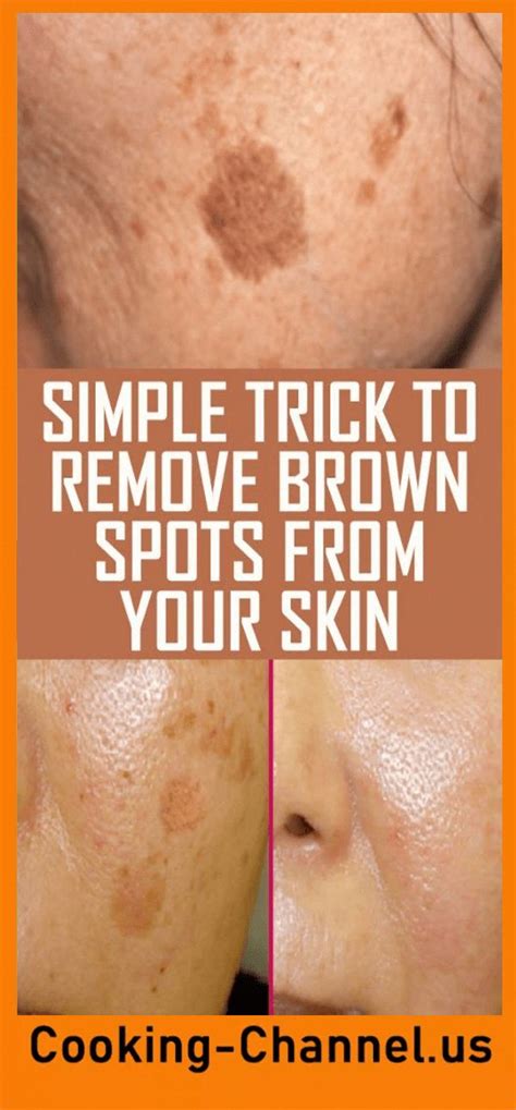 The Best Way To Clear Away Brown Spots On Face Brownspots