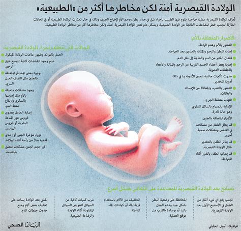 وهي تتضمن عمل جرح فالجدار الامامي لبطن السيده و رحمها. الولادة القيصرية آمنة لكن مخاطر أكثر من الولادة الطبيعية ...