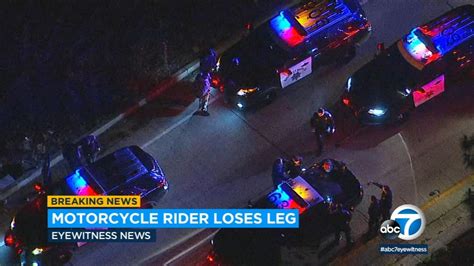 Motorcyclist Loses Part Of His Leg In Granada Hills Crash Abc7 Los