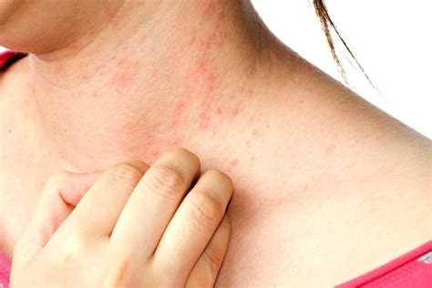 Skin Disease Body Diseases Your Skin Reveals The Healthy