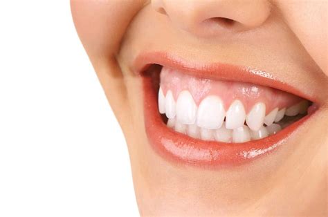 Gummy Smile Treatment In Newport Beach Center For Restorative And Cosmetic Dentistry