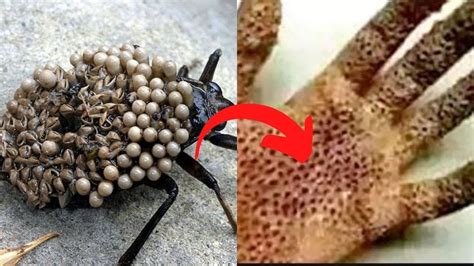Top Most 5 Dangerous Insects In The World Insects Deadliest