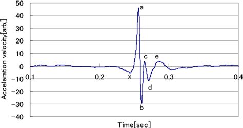 Figure 4 From Study On The Health Index Value Using The Waveform Of The