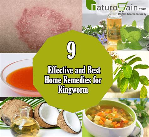 9 Best Home Remedies For Ringworm To Prevent Infection