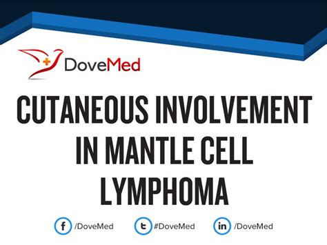 Cutaneous Involvement In Mantle Cell Lymphoma