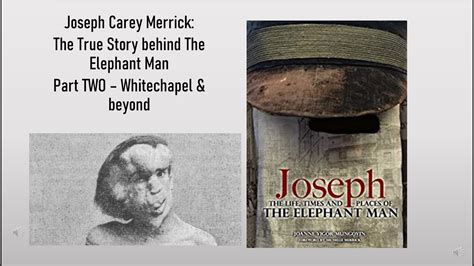 Joseph Carey Merrickthe True Story Behind The Elephant Man Part Two