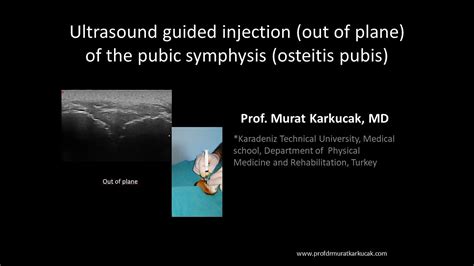 Ultrasound Guided Injection Out Of Plane Of The Pubic Symphysis