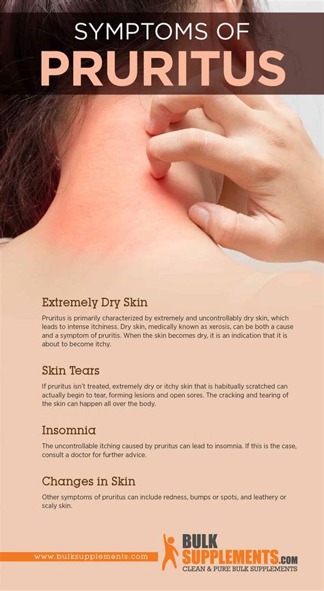 Pruritus Itchy Skin Symptoms Causes And Treatment