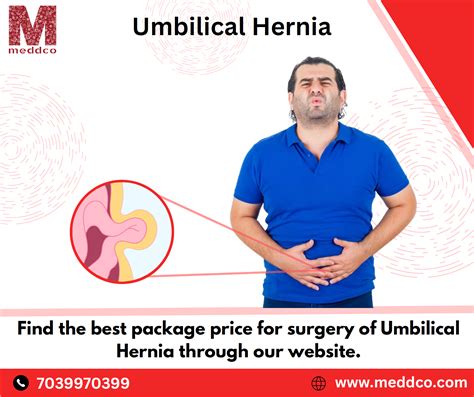 Umbilical Hernia Repair And Surgery Part 2