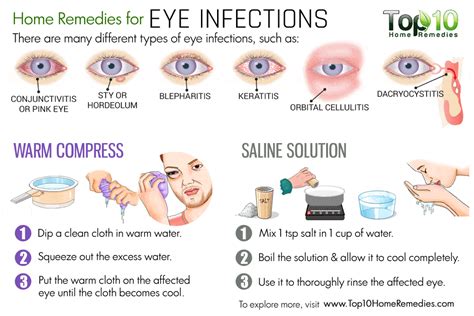 Home Remedies For Eye Infections Top 10 Home Remedies