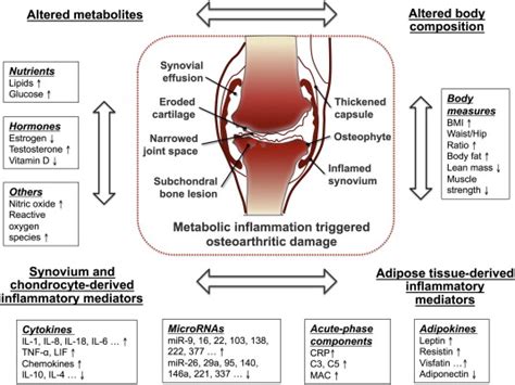 Metabolic Triggered Inflammation In Osteoarthritis Osteoarthritis And