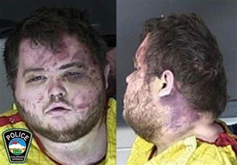 Colorado Gay Club Shooting Suspect Held Without Bail News Herald