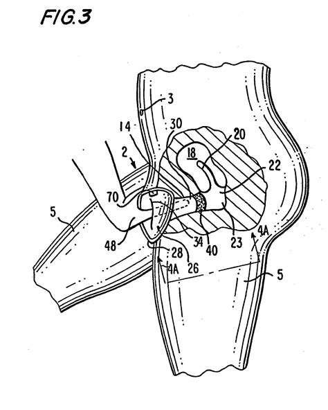Patent Ep1804748b1 Barriere Verhütungsmittel Für Die Frau Mit