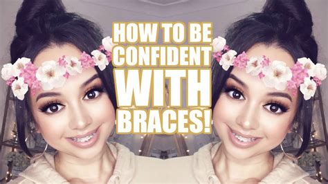 How To Be Confident With Braces Youtube
