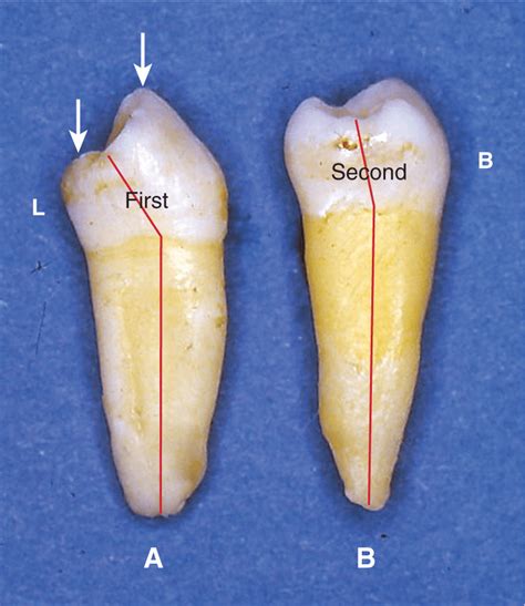 Type Traits That Differentiate Mandibular First From Second Premolars