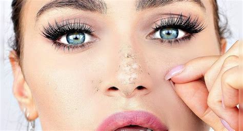 Ways In Which You Can Treat Dry Skin On Your Nose