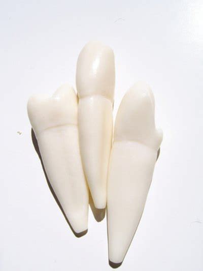The four main reasons a dentist will recommend wisdom tooth removal are: Pain After Tooth Extraction | LIVESTRONG.COM
