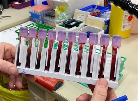The Journey Of A Blood Sample The Daily Scan