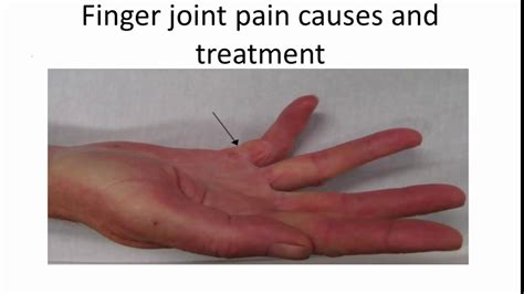 Finger Joint Pain Causes And Treatment Youtube