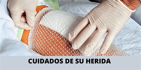 Herida Quirurgica Como Cuidarla Tutraumatologocom