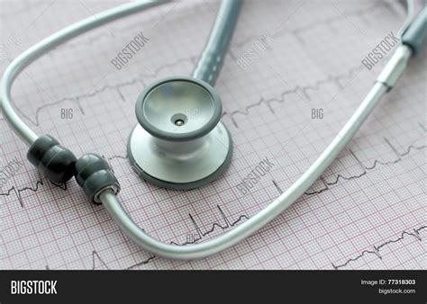 Stethoscope On Ecg Image And Photo Free Trial Bigstock