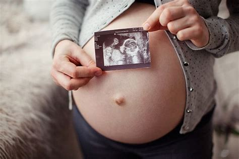 Síndrome de down en el embarazo síntomas pruebas riesgos y más