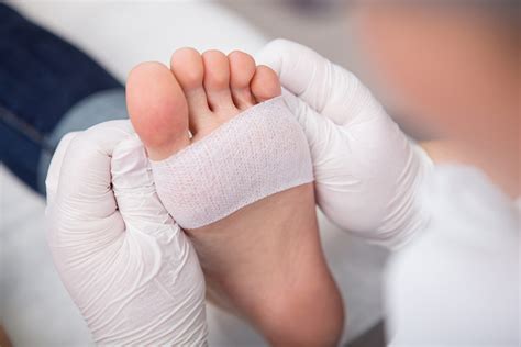 Diabetes And Feet Diagnosis Apollo Sugar Clinics