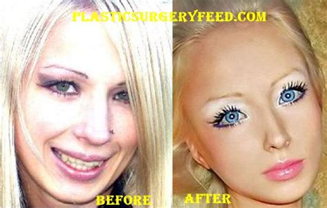 Dream Doll Before Plastic Surgery
