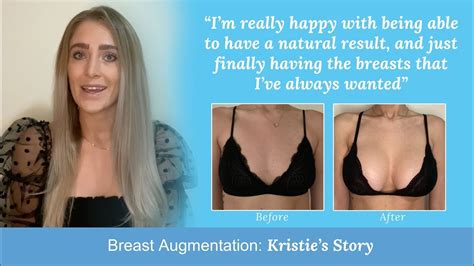 Breast Augmentation Journey Kristie S Story Youtube