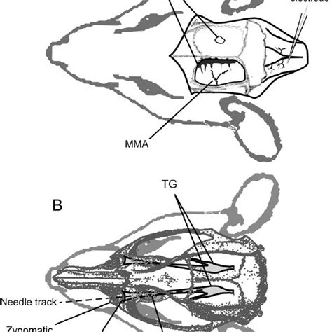 Sections Of The Trigeminal Ganglion With The Three Divisions V1v3 Of