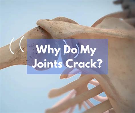 Why Do My Joints Crack Sb Physiotherapy
