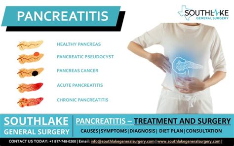 Pancreatitis Treatment And Surgery Southlake General Surgery