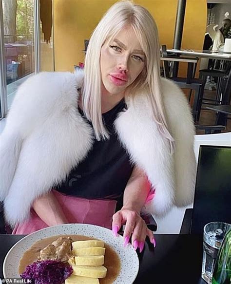 Man Who Had £15000 Of Injections To Look Like Barbie Says His