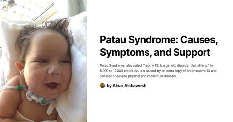 Patau Syndrome Causes Symptoms And Support