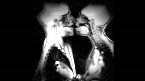 The Anatomy Of Kissing And Love In Magnetic Resonance Imaging Mri Scanner Youtube